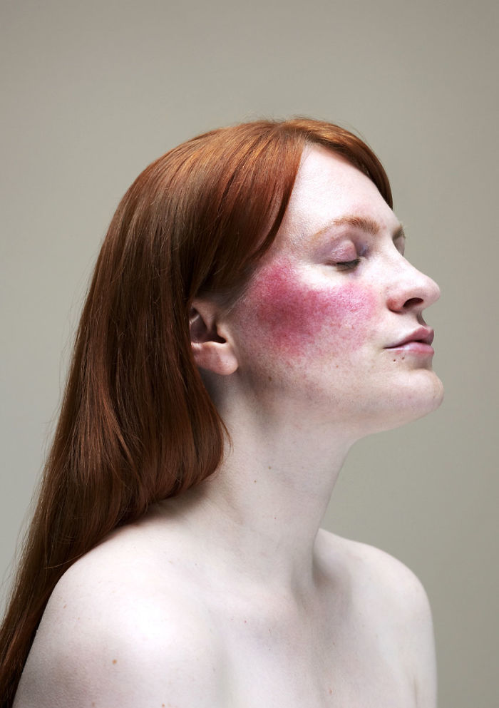 Sophie Harris-Taylor Epidermis