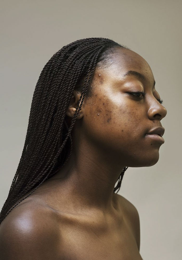 Sophie Harris-Taylor Epidermis