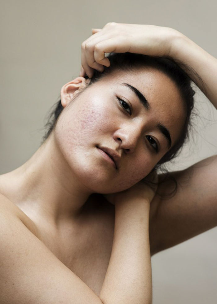 Sophie Harris-Taylor Epidermis